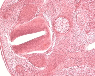 Organogenezis legfontosabb eseményei: Gerinces állatok három meghatározó struktúrája: Chorda dorzális A gerinchúr