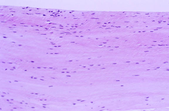 Tömöttrostos kötőszövet: Sok rost szorosan egymás mellett kevés sejt kevés sejtközötti