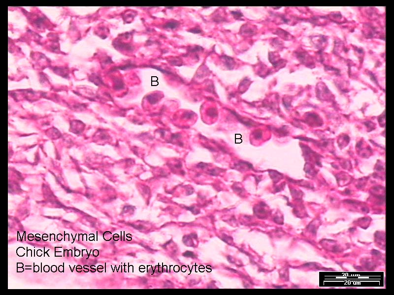 Kötőszövet típusai: mezenchima: mesodermális nyúlványos sejtek folyékony sejtközötti