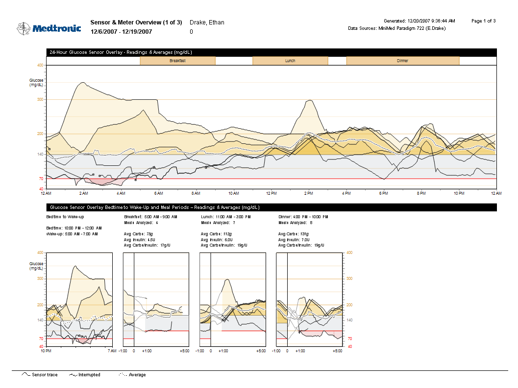 A Sensor and Meter Overview Report (Szenzor- és mérőadatok összefoglaló) jelentés MEGJEGYZÉS: Ez