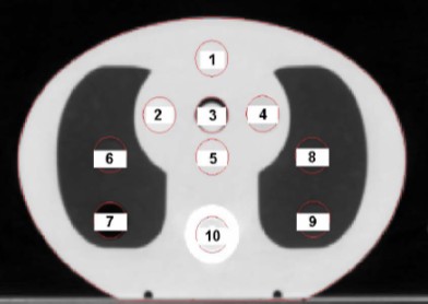 ahol D calc a számolt dózis, D meas a mért dózis, D meas,ref a referencia pontban mért