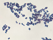 Micrococcus, which, when limited in its extent and activity, causes acute suppurative inflammation (phlegmon), produces, when more