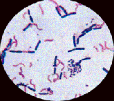 Köszönöm a figyelmet Klebsiella pneumoniae És most