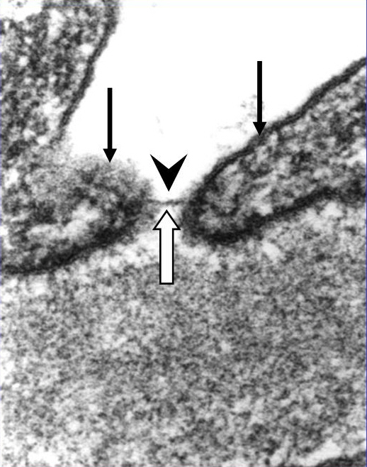 Egészséges vese glomeruláris bazalis membránjának elektronmikroszkópos képe nagy nagyítással.
