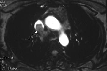 Same patient s MRI with different