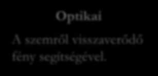 Hogyan vizsgáljuk a szem mozgását?