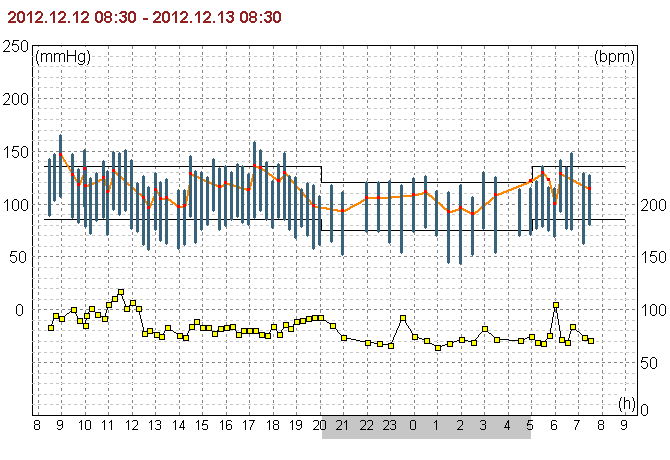 Általános lelet Páciens: Neme: férfi Megjegyzés: Vizsgálat paraméterei Magasság: 18 Súly: 125 kg cm BMI 38.