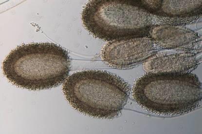 Fontosabb Aspergillus mikotoxinok Aflatoxinok Ochratoxinok,