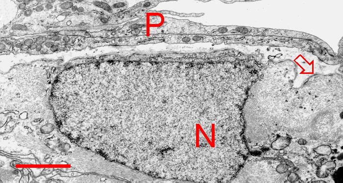 Glia limitans Fibrillary astrocyte filled with gliofilaments participating in glial limiting membrane (N - nucleus).