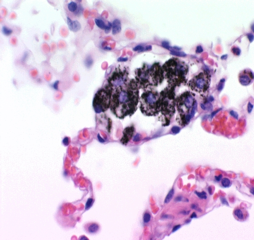 Makrofágok Lumenen belüli "szabad" sejtek