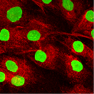 A jobb oldalon látható immunfestéseket TGF- 1 kezelt, permeabilizált és nem permeabilizált sejteken végeztük. A PXDN tartalmú rostok festődése megmarad a nem permeabilizált sejteken is.