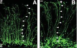 FABP7 (BLBP) Fatty acid binding protein 7 Brain lipid binding protein Radiális glia (DHA: Docosahexaenoic acid enriched in the brain) - hosszú láncú PUFA-kat köt (polyunsaturated fatty acids)