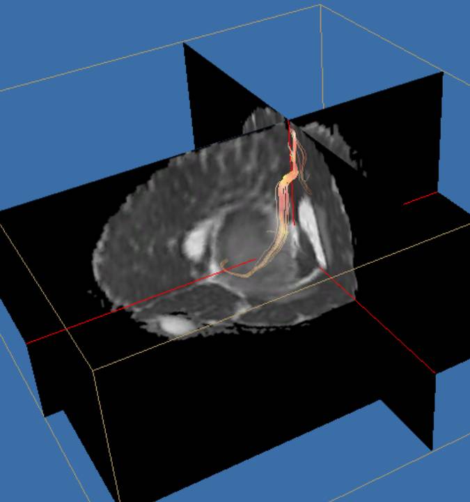 Örök kíváncsiság: az emberi test felépítése és működése A Röntgen-sugárzás és alkalmazása (CT) Izotópdiagnosztika (Gammakamera,