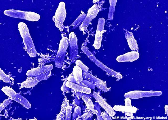 Mikroorganizmusok - baktériumok Escherichia coli http://faculty.ccbcmd.edu/courses/bio14 1/labmanua/lab6/images/Ecoli01_scale.j pg http://www.path.cam.ac.uk/micro biology/bi_bacteriology/cl_clos tridia/m_bi_cl_20small.