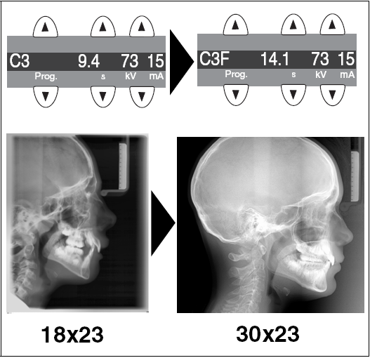 7 Kefalometriás felvételek (Ceph) C3F program a teljes formátumhoz (30 23) A C3F (30 23) program lehetővé teszi egy teljes formátumú laterális felvétel elkészítését.