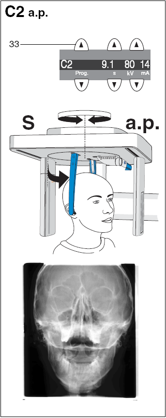 7 Kefalometriás felvételek (Ceph) C2 a.p. felvétel (S = szimmetrikus) Válassza ki a C2 ceph programot a program gombok (33) segítségével a Multipadon.