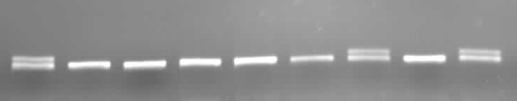 11. ábra A TLR-4 Asp299Gly polimorfizmusának vizsgálata; Bal oldalon a DNS marker létra látható, mellette négy sávban, és az alsó ábrán a vizsgált hasadási termékek: nem hasad, vad- AA; részlegesen