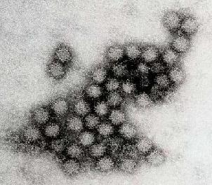 vizsgált vírusokról denoviridae (HdV) dsds vírus Humán d 6 csoport: -F Vízben leginkább F: d40, d41 Hányás, hasmenés Továbbá C: d2, d5 Főként légúti megbetegedések incs szezonalitása, de csak