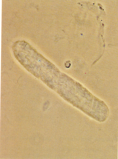 baktérium Vvt. Dysmorph - (vvt+/-) (leukocyta+/-) - (protein+/-) Protein ++ (0.