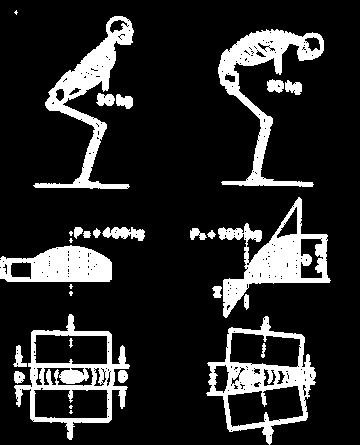 Kézi tehermozgatás (5) 50 kg tömeg egyenes háttal történő emelésekor az ágyéki csigolyák porckorongjának minden egyes cm 2 -jére 400 kp nyomás nehezedik kb.