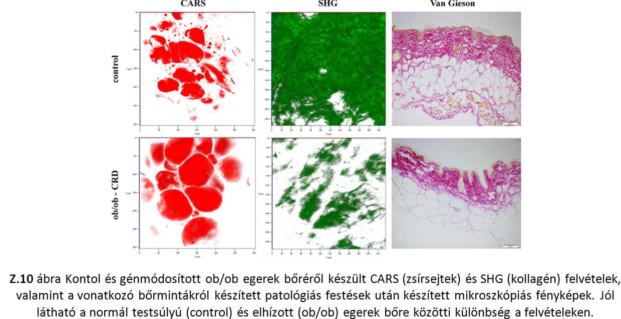 A 2. típusú diabétesz és a bőr kollagén szerkezetének vizsgálata ob/ob knockout egereken, in vivo Haluszka, D.