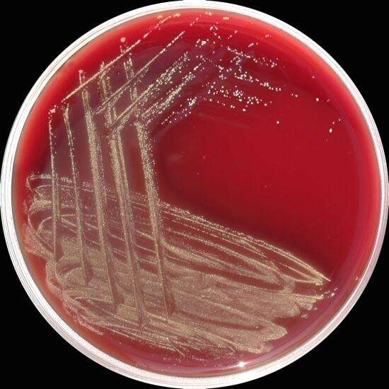 Actinomyces Anaerob, nem spórás, Gram pozitív, szabálytalan alakú pálcák