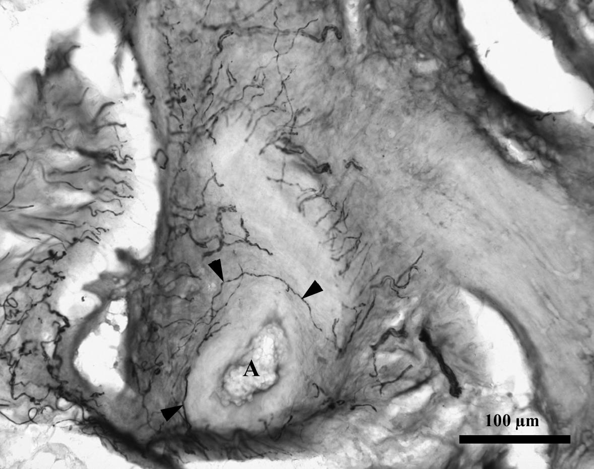 24. ábra. Gyulladt humán epehólyag falának részlete. Közvetlenül az erek körül számos NPY IR idegrost figyelhető meg (A: arteriola) Lépték = 100 m 25.