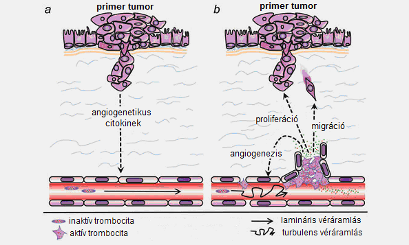 3.7.5. A trombociták szerepe a daganatnövekedésben és a tumor indukálta angiogenezisben Az angiogenezis alapvető lépés az áttétképzés folyamatában.