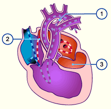 HBSZSZ 1 Ductus arteriosus 2 Foramen