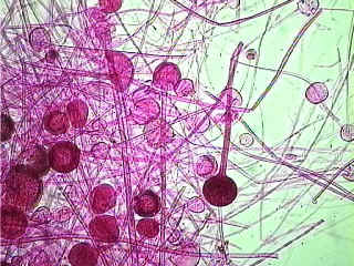 élesztőgombák = sarjadzó egyedi, ovális sejteket képeznek (3-15 µm) bimbózással szaporodnak -