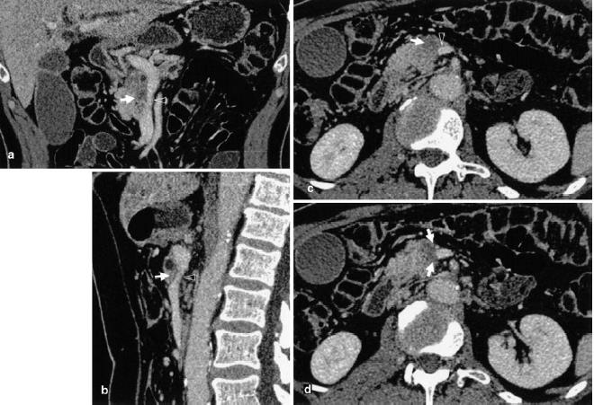 PANCREAS FEJI