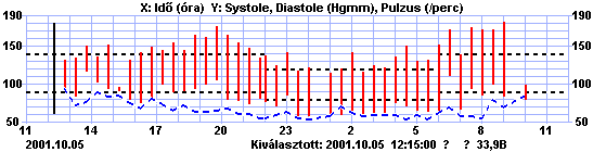 A vérnyomásemelkedés kedvezőtlen hatásai 30 25 20 15 10 5 0 2óra 4 6 8