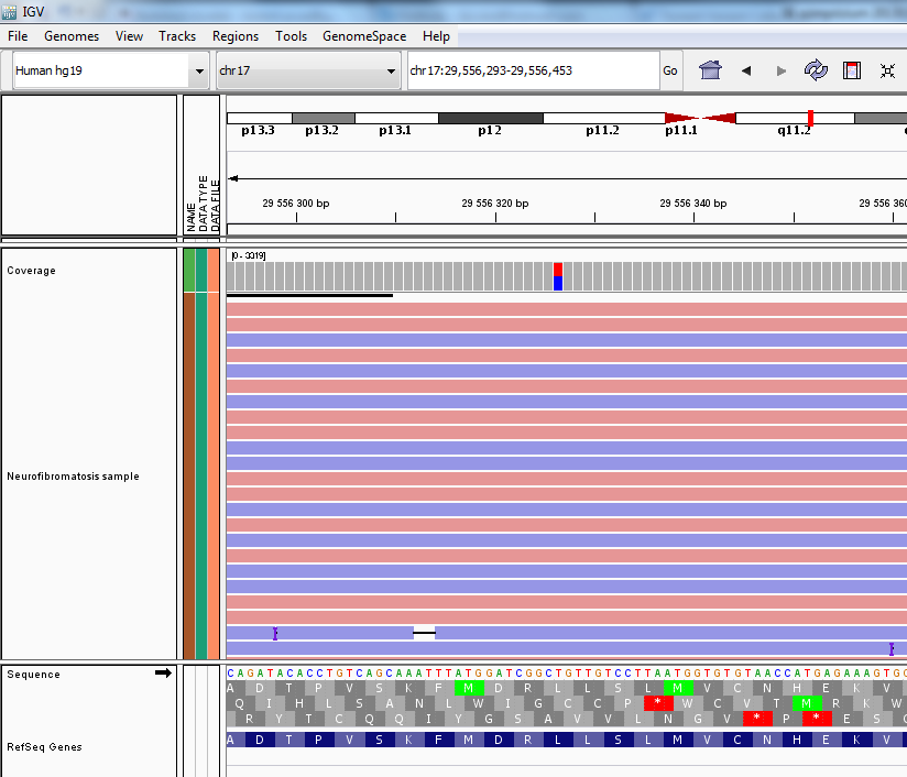 Neurofibromatózis Ampliseq panel NF AmpliSeq panel, 130 amplikon c.