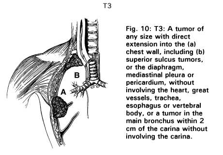 T 3