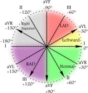 EKG