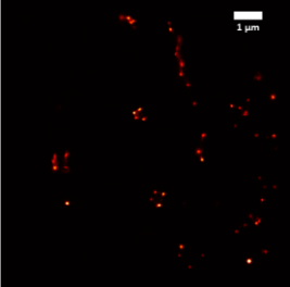 150mW @642 nm Aβ 1-42 fibril (in vitro) 500 nm EGF receptors forming pits and