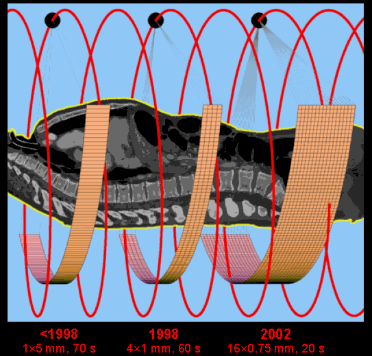 7G Multislice CT spiral CT cone beam instead fan beam array