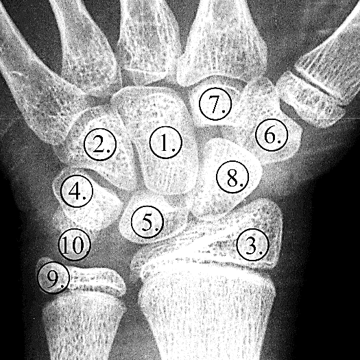 2. Szakirodalmi áttekintés 2.1 A kéz anatómiája és fejlődése A tenyér nyolc kéztőcsontból (ossa carpiból) áll, amelyek két sorban négyesével rendeződnek.