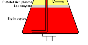 Plasma separator
