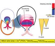 PISA mérés ( Level 2 ) r- a convergencia hemisphere radiusa Va-aliasing sebesség