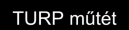 TURP