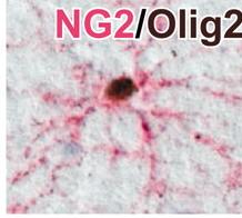 Oligo-progenitor markerek: GD3 gangliozid NG2 kondroitin-szulfát proteoglikán, PDGF-aR, Olig2 (ventrális OPC) Érett oligo- markerek: O4,