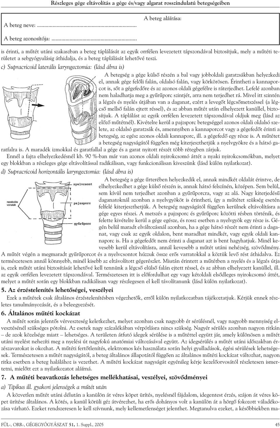 c) Supracricoid laterális laryngectomia: (lásd ábra is) A betegség a gége külsõ részén a bal vagy jobboldali garatzsákban helyezkedi el, annak gége felõli falán, oldalsó falán, vagy körkörösen.