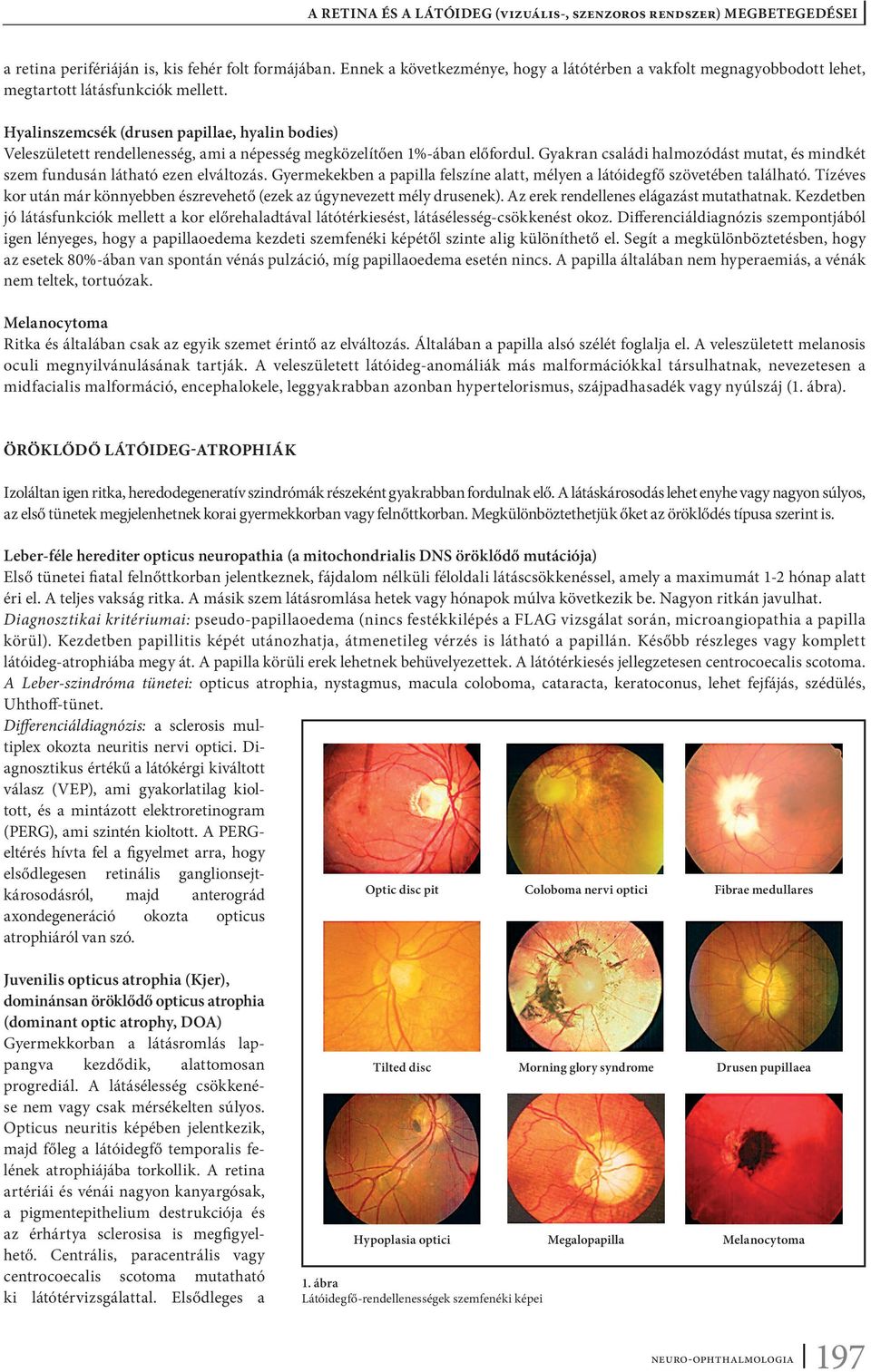 a vizuális rendszer fő rendellenességei hogy a citramon hogyan befolyásolja a látást
