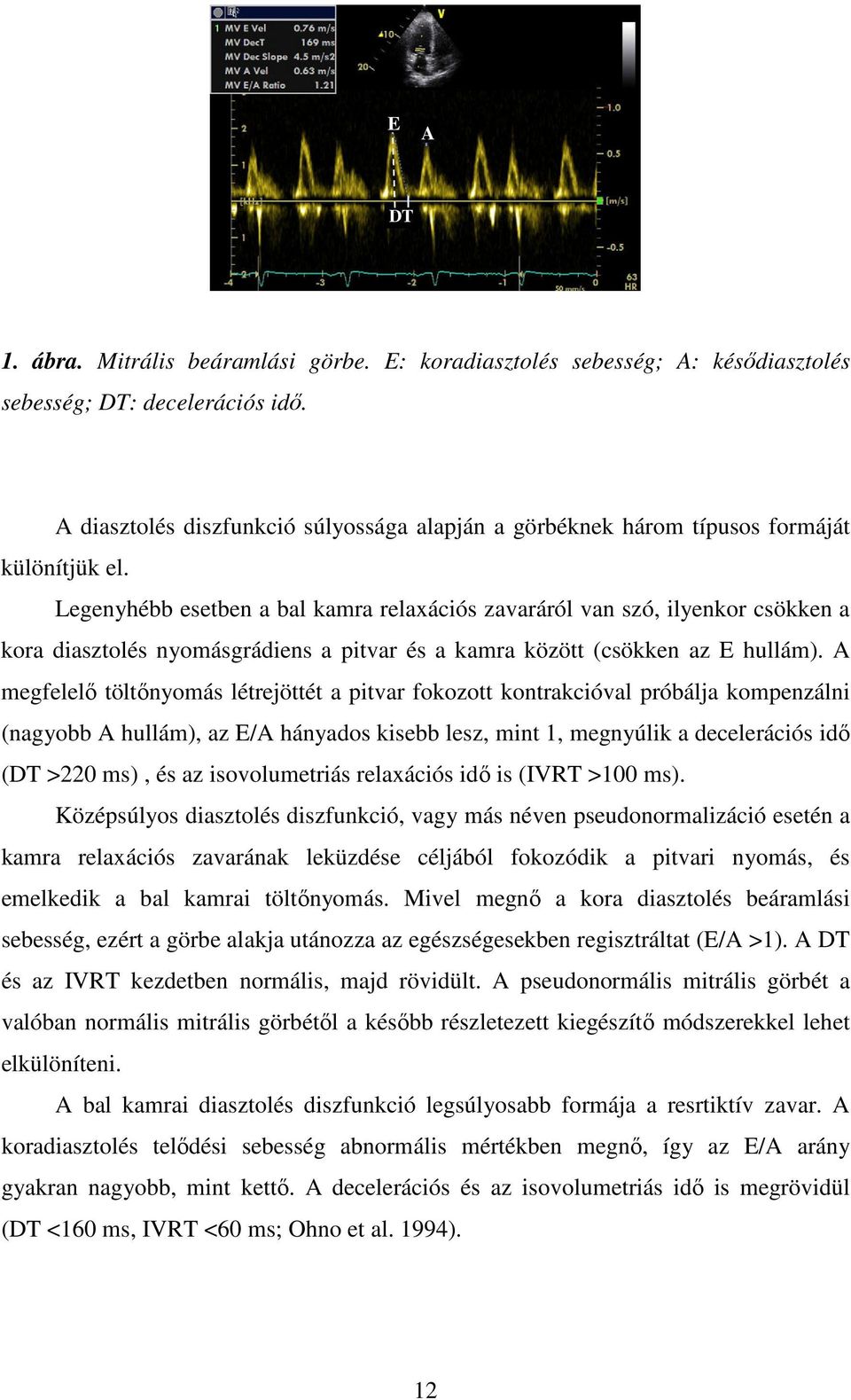 Legenyhébb esetben a bal kamra relaxációs zavaráról van szó, ilyenkor csökken a kora diasztolés nyomásgrádiens a pitvar és a kamra között (csökken az E hullám).