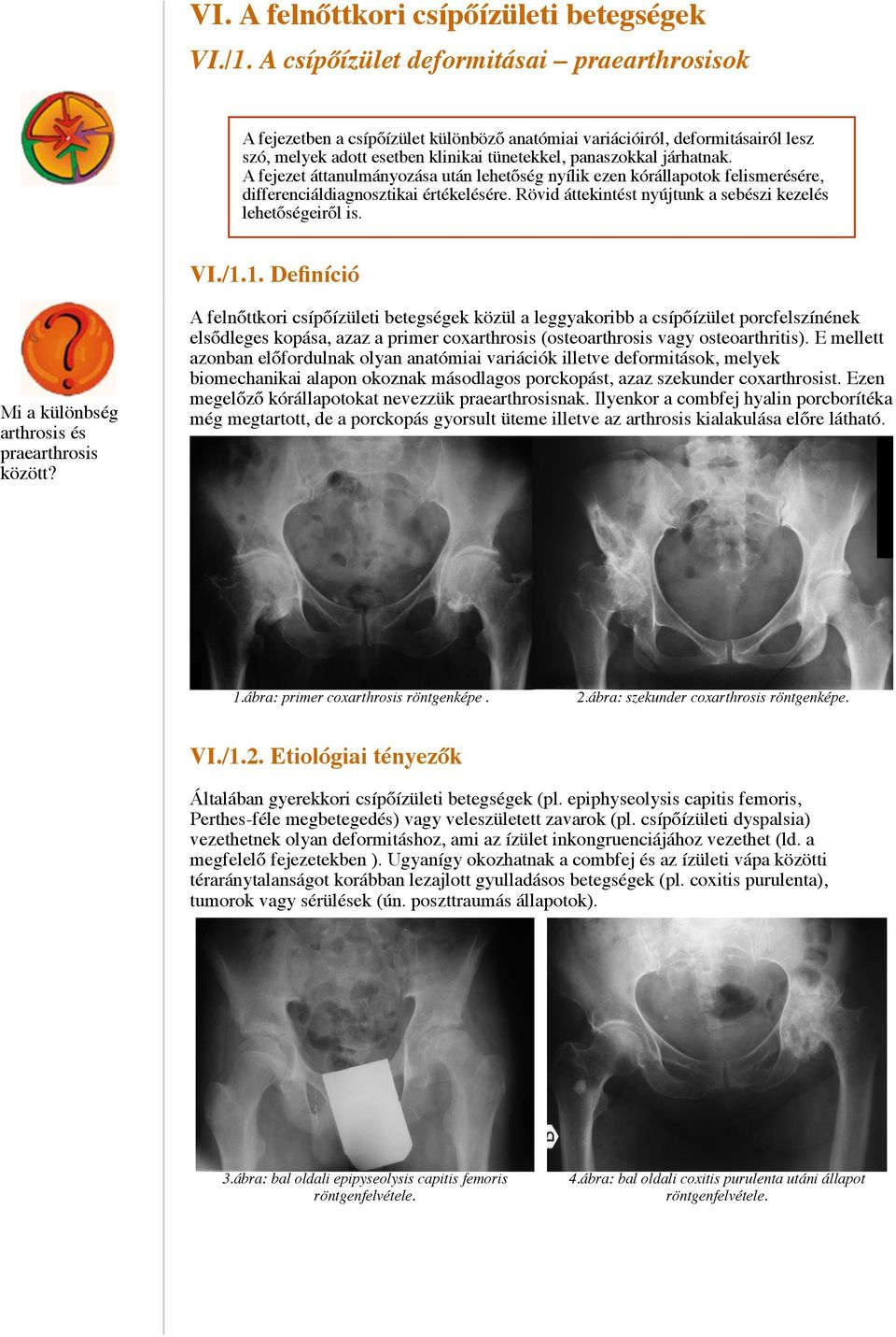 VI. A felnőttkori csípőízületi betegségek