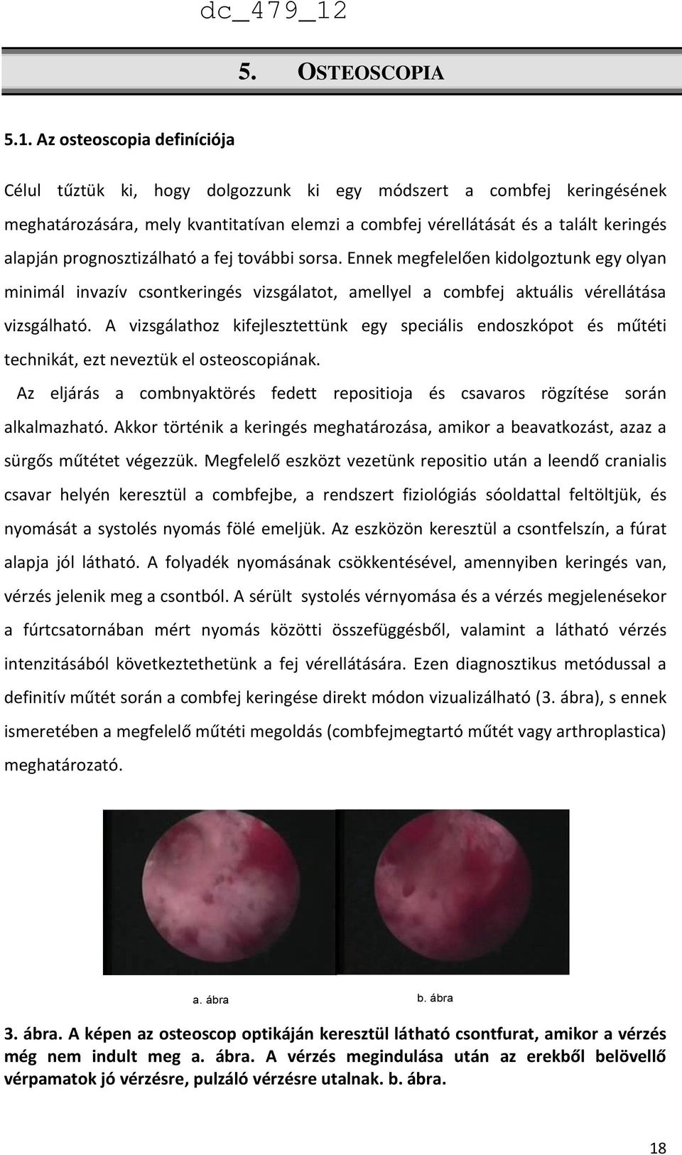prognosztizálható a fej további sorsa. Ennek megfelelően kidolgoztunk egy olyan minimál invazív csontkeringés vizsgálatot, amellyel a combfej aktuális vérellátása vizsgálható.