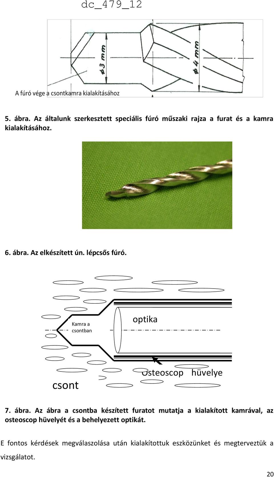 Az ábra a csontba készített furatot mutatja a kialakított kamrával, az osteoscop hüvelyét és a behelyezett