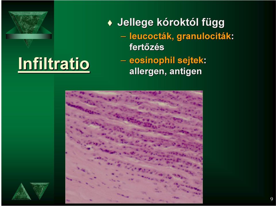 fertőzés eosinophil sejtek: allergen,