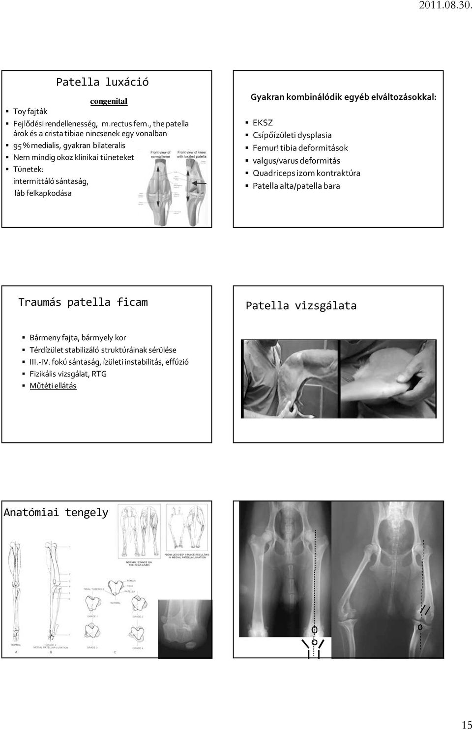 láb felkapkodása Gyakran kombinálódik egyéb elváltozásokkal: EKSZ Csípőízületi dysplasia Femur!